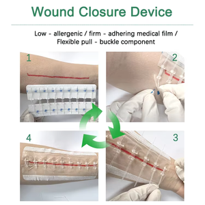 Terommed hidrokoloid jahitan luka penutupan hidrocoolid Zip jahitan penutupan perekat Zip Lock jahitan - Product Image 4