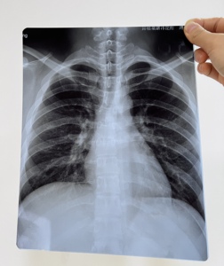 Bán buôn A3 tùy chỉnh kích thước tấm cuộn màu xanh phun y tế phim cho y tế in ấn hình ảnh x Ray ct, CR, Dr, MTR, PET-CT vv. - Product Image 4