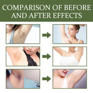 Vente en gros Soin de beauté bio 30ml Crème éclaircissante au lait pour aisselles corps Zones sensibles Jambes - Product Image 6