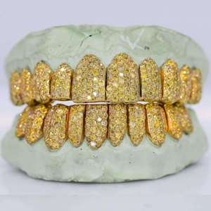 Grillz de Plata de Ley 925 Personalizados con Diamantes de Moissanita para Hombres y Mujeres, Joyería Dental Iced Out, Accesorios de Lujo para Moda Urbana - Product Image 2