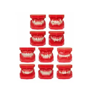 Modèle d'étude des malocclusions dentaires de classification ortho dentaire