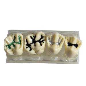 Modelo de Sellador de Fisuras Dentales Transparente para Niños, para la Prevención de Caries, Procedimiento de Obturación Dental, Accesorio de Equipo de Terapia Oral - Product Image 1