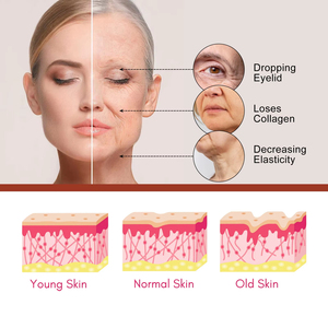 Esencia facial de ácido hialurónico, antiarrugas y Antienvejecimiento, reafirmante, piel amarilla, brillo y aclaramiento - Product Image 6