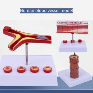 Model Anatomi Arteri Koronari Patologis Manusia Model Ilmu Kedokteran PVC Model Aterosklerosis - Product Image 3