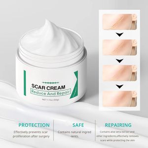 Crema Aclaradora para la Piel Postoperatoria para Quemaduras 50g Transfronteriza - Product Image 4