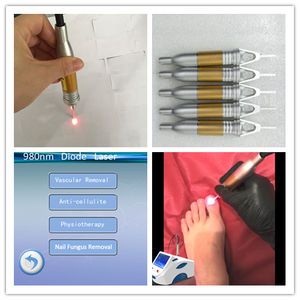 Mesin <span class=keywords><strong>Laser</strong></span> Diode 980nm untuk Pengobatan Jamur Kuku Onikomikosis, Podiatri, Kutil Telapak Kaki, Onikomikosis - Product Image 4