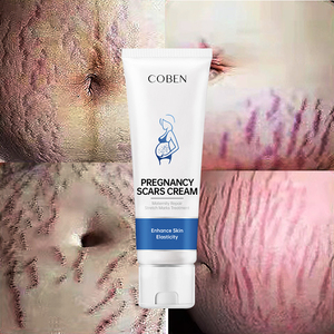 Lotion pour l'élimination des vergetures sur le corps féminin de marque privée crème pour les vergetures et les cicatrices - Product Image 1