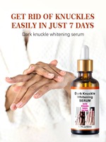 Sérum Liquide Éclaircissant pour les Mains à la Niacinamide Dark Knuckle – Essence Blanchissante à Base de Plantes pour Éliminer les Taches Pigmentaires et Éclaircir les Doigts