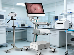 Colposcopio Óptico Digital de Alta Calidad para Imágenes Precisas, Colposcopia, <span class=keywords><strong>Examen</strong></span> Ginecológico - Product Image 1