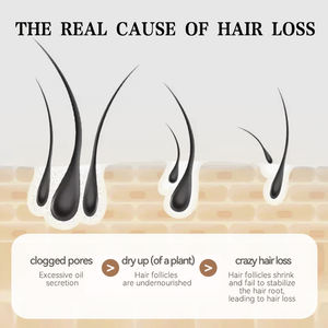 <span class=keywords><strong>แชมพู</strong></span>ปลูก<span class=keywords><strong>ผม</strong></span><span class=keywords><strong>สำหรับ</strong></span><span class=keywords><strong>คน</strong></span>ที่ย้อมผมแชมพูปลูก<span class=keywords><strong>ผม</strong></span>งอกใหม่ป้องกันการหลุดร่วงของต้นชา - Product Image 3