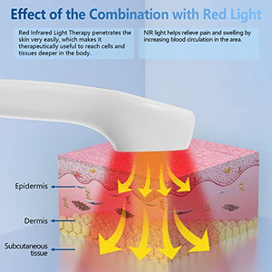 Alat terapi <span class=keywords><strong>Laser</strong></span> genggam dokter hewan untuk menghilangkan rasa sakit - Product Image 4