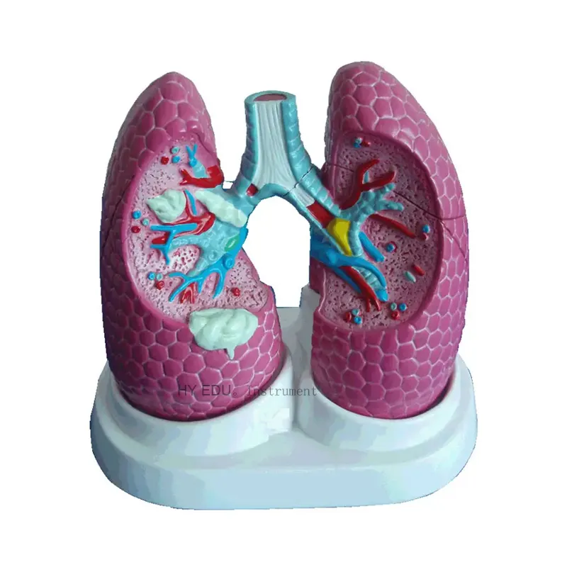 Fabrika doğrudan sağlanan insan akciğer kanseri biyoloji modeli
