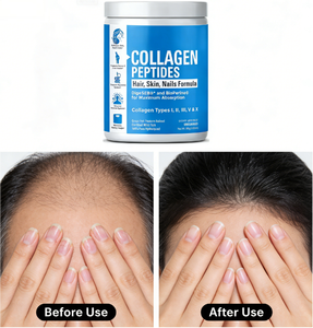 Poudre de peptides de collagène |   Types I, II, III, V <span class=keywords><strong>et</strong></span> X |   avec DigeSEB & BioPerine pour la santé des <span class=keywords><strong>cheveux</strong></span>, de la peau, des ongles <span class=keywords><strong>et</strong></span> des articulations - Product Image 6