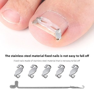 Ein gewachsenes Zehennagelkorrektor-Kit für Männer Frauen Ein gewachsenes Nagel werkzeug 2 Edelstahl clips Gebogene Nagelst reifen & Zehen polster - Product Image 3