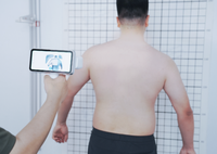 SHINING 3D EinScan Medixa Scanner 3D sans fil tout-en-un pour la mesure corporelle en orthopédie et prothésie