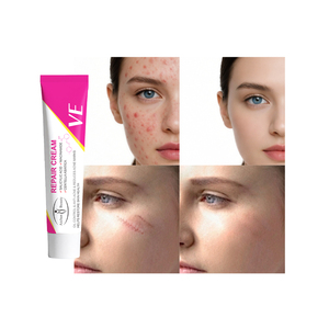 Crema Facial con Vitamina E de Marca Privada para Cosméticos, con Ácido Salicílico y Niacinamida, Reduce Marcas de Acné, Cicatrices y Enrojecimiento - Product Image 4