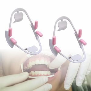 Écarteur de joue dentaire 3D élastique pratique, écarteur buccal intra-oral, ouvre-bouche pour accessoires dentaires, 2 pièces (S) - Product Image 1