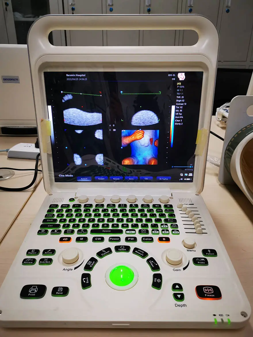 מכונת אקולגרפו רפואית ניידת דופלר לב 3D 4D אולטרסאונד לגינקולוגיה
