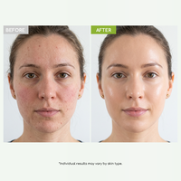 Nettoyant Visage OEM Apaisant à l'Huile de Jojoba et de Graine de Maracuja, Complexe Anti-Rides Bio, Nourrissant et Renforçant la Barrière Cutanée