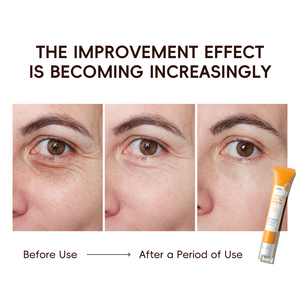 Sérum pour les yeux anti-âge LAIKOU 20g à la vitamine C avec applicateur à bille pour les cernes, les rides et les ridules, éliminateur de poches sous les yeux - Product Image 5