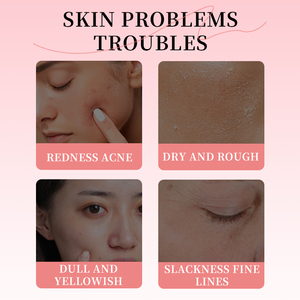 Hot Bán Hàn Quốc Sinh Học Collagen Sâu Ngủ Mặt Nạ 34G * 4Pcs Du Lịch Kích Thước Mặt Nạ Kem Màu Hồng Cho Giữ Ẩm Làm Săn Da Làm Trắng Khuôn Mặt - Product Image 3