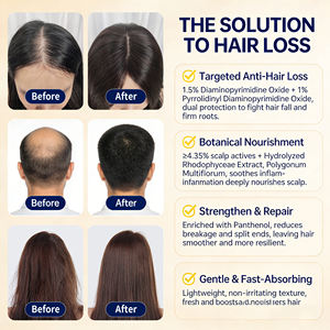 Shampoo de croissance rapide des cheveux OEM, soin du cuir chevelu, gingembre, ginseng, biota orientalis, antipelliculaire, bloqueur de DHT, shampooing <span class=keywords><strong>anti</strong></span>-<span class=keywords><strong>chute</strong></span> de cheveux - Product Image 4