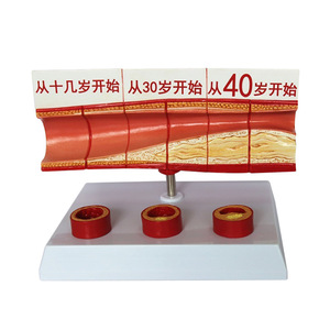 Modèle de thrombose ; Système cardiovasculaire humain avec artères atherosclérotiques ; Modèles de visualisation vasculaire à différents stades de la vie. - Product Image 3