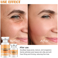Poudre lyophilisée de protéase coréenne personnalisée Peeling enzymatique Contrôle des pores Traitement enzymatique exfoliant anti-âge Y