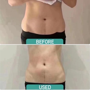 Crème de massage amincissante au gingembre pour le corps, produits pour un <span class=keywords><strong>ventre</strong></span> <span class=keywords><strong>plat</strong></span>, <span class=keywords><strong>gel</strong></span> de massage amincissant, brûleur de graisse pour un <span class=keywords><strong>ventre</strong></span> <span class=keywords><strong>plat</strong></span>, éliminateur de graisse - Product Image 4