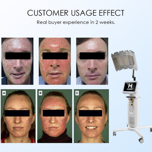 2025 mới nhất PDT LED chiếu sáng Beauty Salon máy ánh sáng màu xanh trị liệu điều trị mụn trứng cá/liệu pháp ánh sáng đỏ PDT máy - Product Image 5