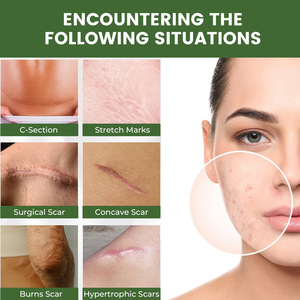 Crème réparatrice de cicatrices à usage externe avec des ingrédients à la camomille pour une utilisation quotidienne sûre des soins de la peau - Product Image 2