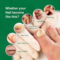 Sérum de traitement fongique des ongles OEM sérum de soin liquide pour la réparation des pieds gel blanchissant pour l'élimination des champignons des ongles des orteils 10ML