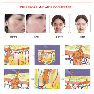 Appareil multifonctionnel 7-en-1 pour le soin du visage à jet d'oxygène, microdermabrasion, rajeunissement de la peau - Product Image 6