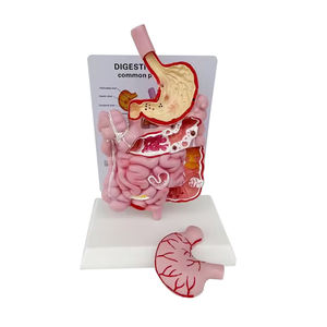 ระบบย่อยอาหารที่มีโมเดลกายวิภาคของกระเพาะอาหารแบบจำลองระบบทางเดินอาหารทางการแพทย์ SMD0333ระบบย่อยอาหารของมนุษย์โมเดลทรัพยากร PVC - Product Image 3