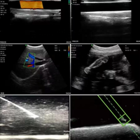 B26G Doppler de color inalámbrico de doble cabezal 3 en 1 Escáner de ultrasonido Sonda lineal/convexa/en fase
