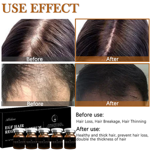 Y Cabelo Regrowth Hair Loss Tratamentos Restauração do crescimento Erva orgânica natural Custom Anti Hair Loss Serum - Product Image 5