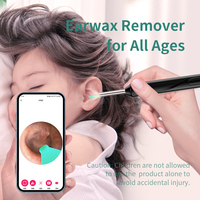 Otoscope sans fil HD pour le retrait du cérumen avec caméra, outil de retrait du cérumen électrique rechargeable par USB, nettoyeur d'oreille intelligent WIFI