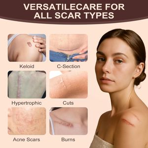 Private Label Geavanceerde Siliconen Littekengel Medische Kwaliteit Striae Brandt Keloïde Acne Littekens Verwijderaar <span class=keywords><strong>Gel</strong></span> Voor Oude En Nieuwe Littekens - Product Image 4