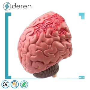 Modelo de Cerebro para Epilepsia Tipo Maniquí, Material PLA, para Hemorragia Cerebral, Malformación Arteriovenosa, Patología - Product Image 5