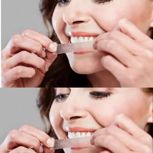 1 scatola 7 sacchetti laboratorio dentale candeggina igiene orale cura denti denti pulito bianco profondo sbiancamento viaggi attrezzatura candeggina - Product Image 2