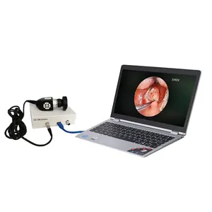 factory hot sell medical hd usb endoscope camera system