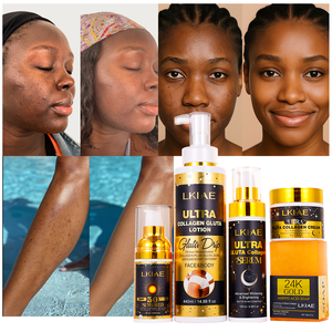 Loción Hidratante de 72 Horas de Marca Privada OEM, Glicerina, Niacinamida, SPF 50+, Juego de Cuidado de la Piel para Desvanecer Cicatrices, Blanquear e Iluminar - Product Image 1