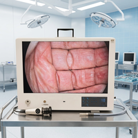 Système de caméra endoscopique intégré 3 en 1, caméra, lumière et moniteur combinés pour la laparoscopie