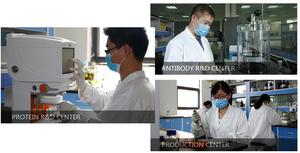 İnsan kolajen <span class=keywords><strong>autoantibody</strong></span>,CLA için ELISA seti
