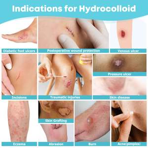 Apósito en rollo hidrocoloide para úlceras venosas del fabricante - Product Image 2