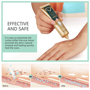 ELAIMEI Gel Avancé Anti-Acné, Crème <span class=keywords><strong>Vergetures</strong></span>, Gel Réparateur Cicatrices et <span class=keywords><strong>Pommade</strong></span> Élimination Marques d'Acné <span class=keywords><strong>pour</strong></span> Soin Visage et Corps - Product Image 5