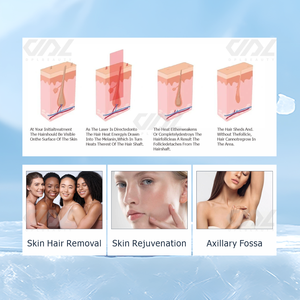 Ice Cool Painless Bikini Underarm Facial Hair Tattoo Removing Melasma Freckle Clear Carbon Facial Skin Care Machine - Product Image 3