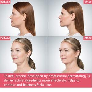 Masque facial amincissant OEM pour double menton, patch liftant en V pour le visage - Product Image 4