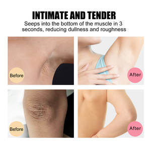 EELHOE Savon pour le corps éclaircissant pour la peau Savon solide blanchissant pour le nettoyage quotidien et diluant de mélanine pour les aisselles - Product Image 6