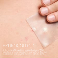 Patchs anti-acné à marque privée, patchs hydrocolloïdes pour éliminer les boutons, patchs pour le corps